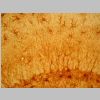 Astroglia GFAP 11.jpg